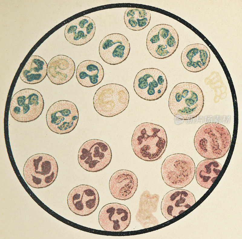 多核人类白细胞的显微镜观察- 19世纪